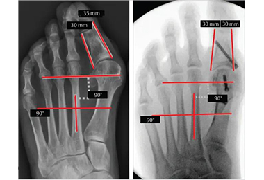 Symptoms-Necessitating-Surgery.jpg